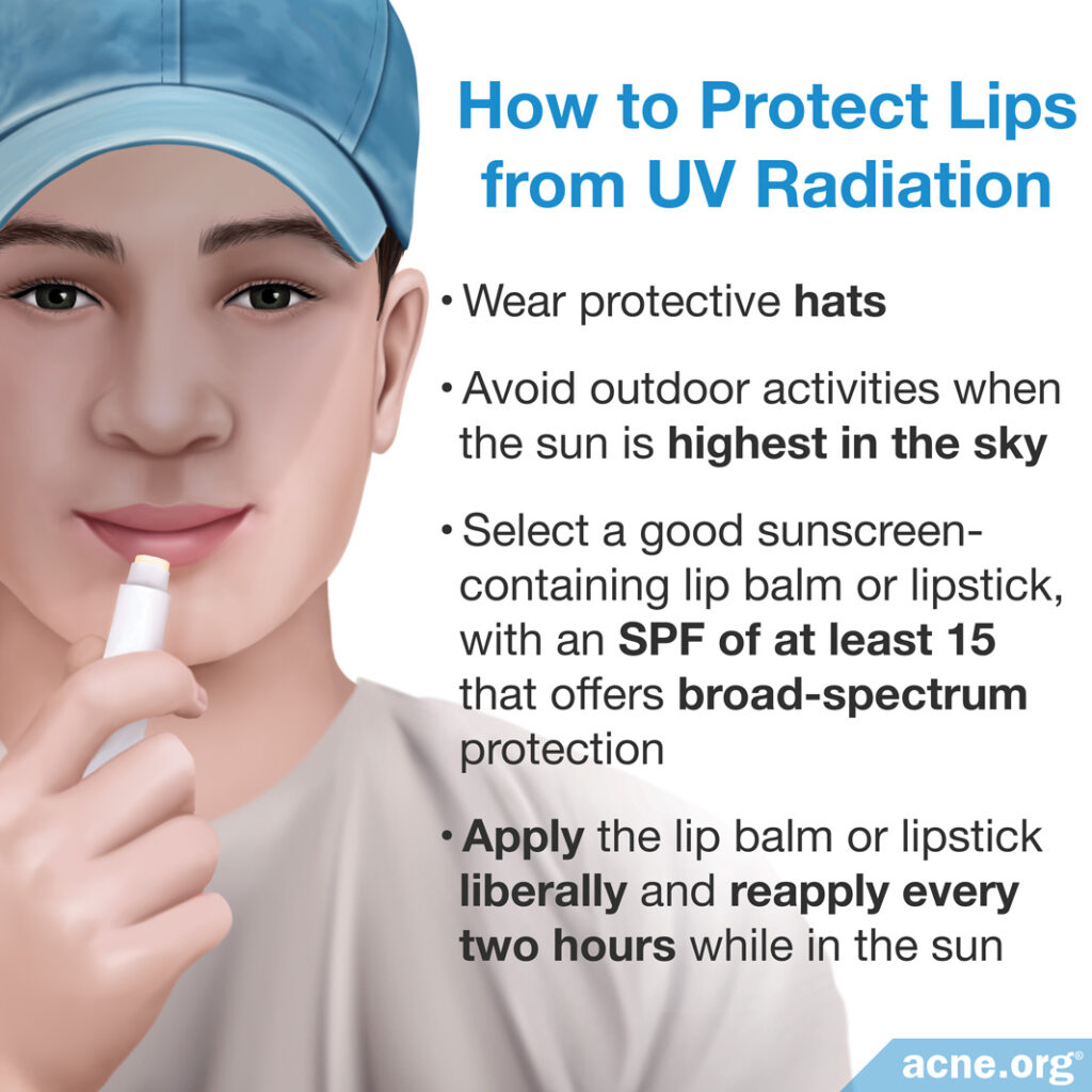 How to Protect Lips from UV Radiation