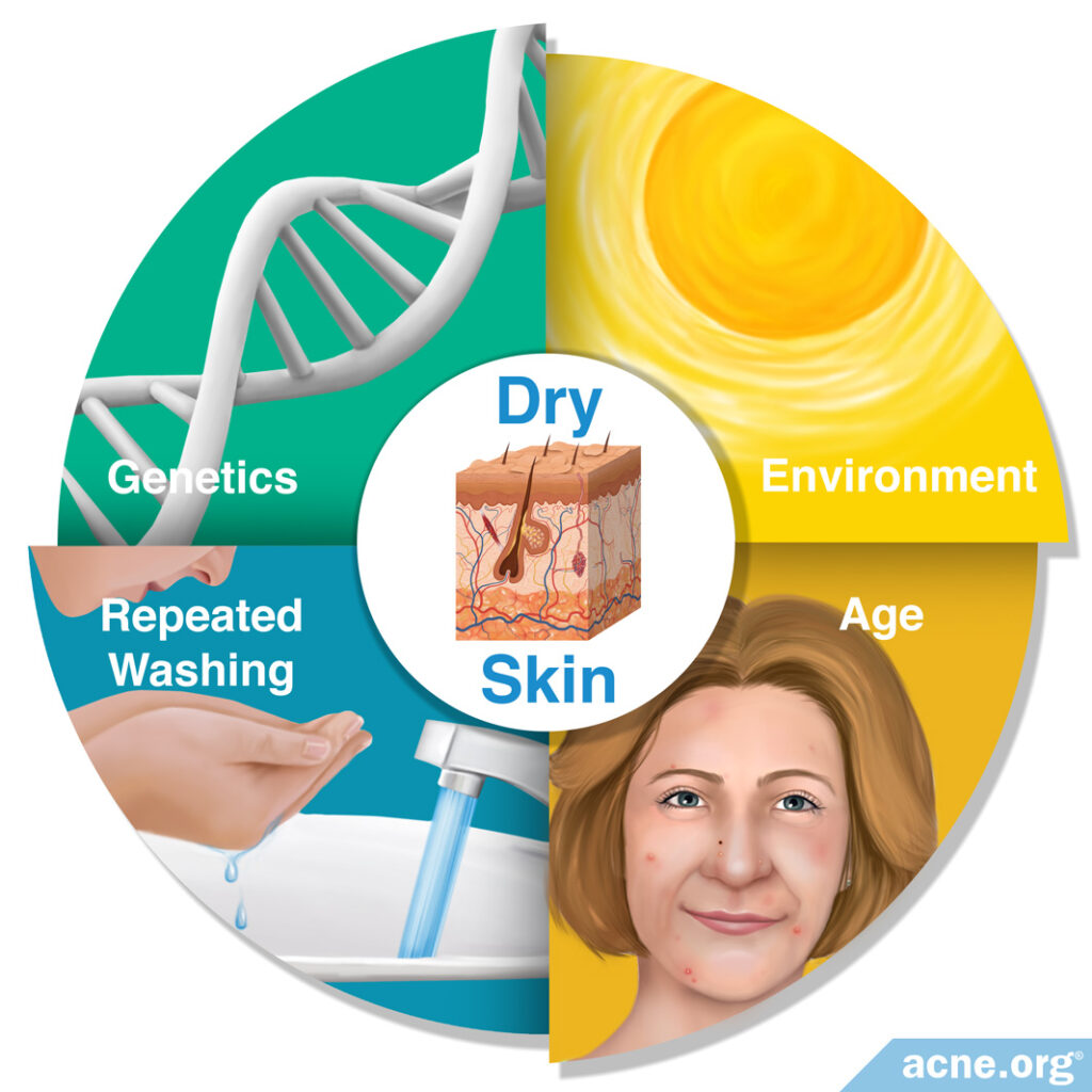 Dry Skin Causes