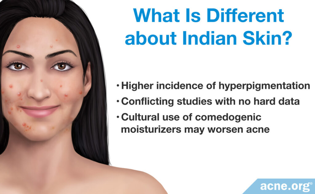 What is different about Indian skin?