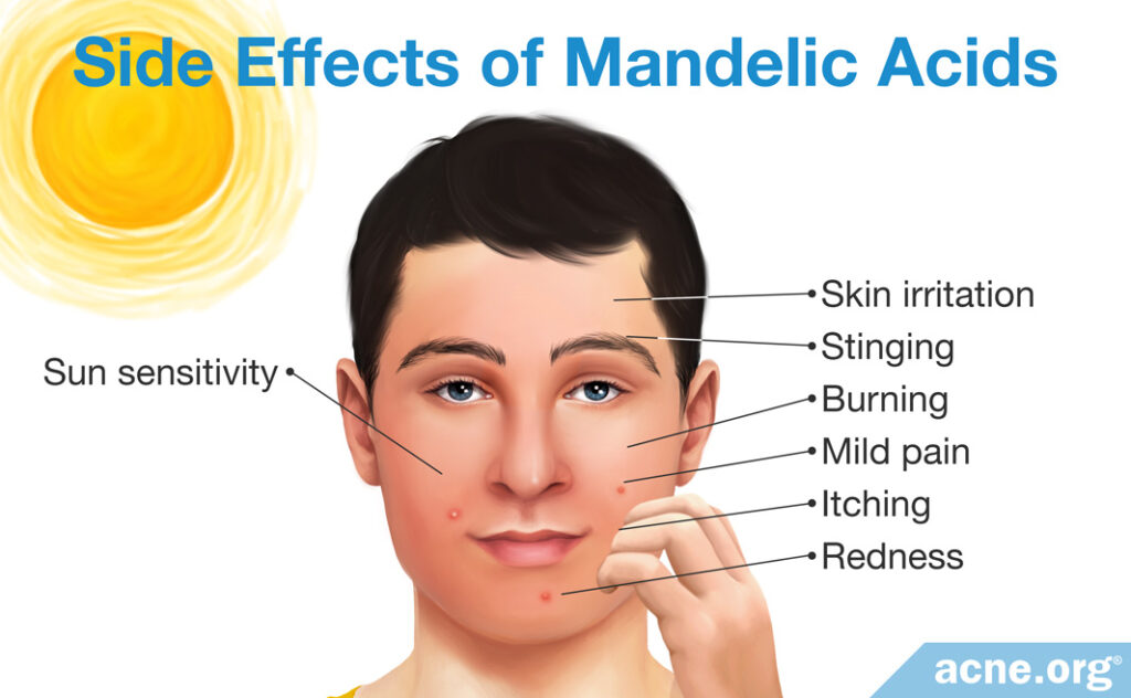 Side Effects of Mandelic Acids