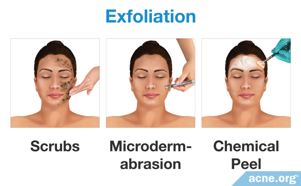Exfoliation - Scrubs, Microdermabrasion, and Chemical Peels