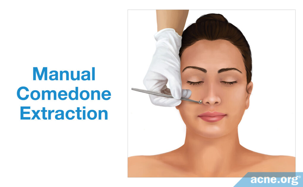 Is Getting a Facial Good for Acne?