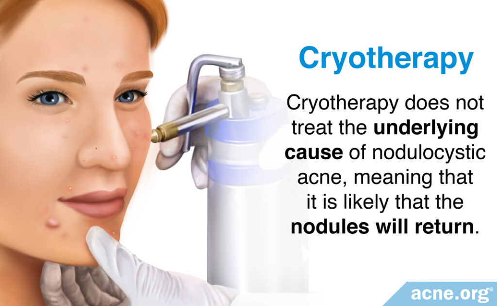 Cryotherapy