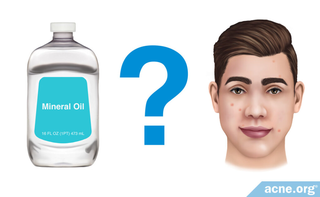 Mineral Oil for Acne Treatment?