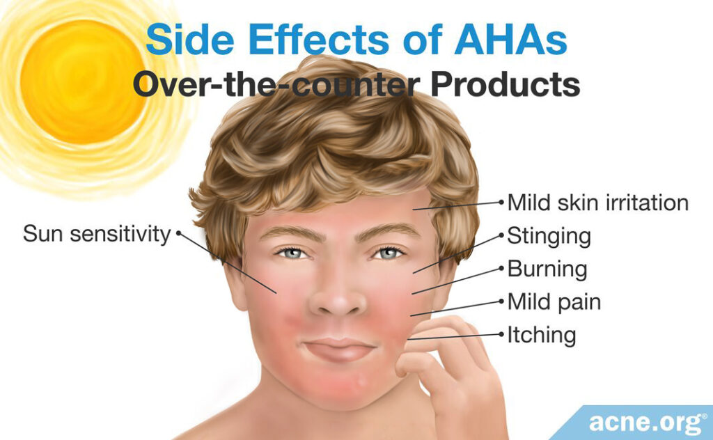 Side Effects of Over-the-counter AHAs Products