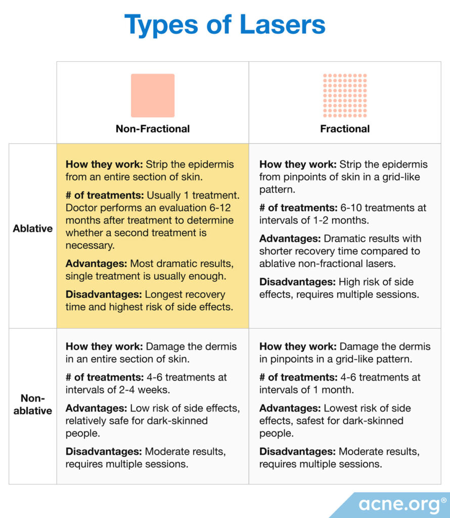Types-of-Lasers-Chart-Ablative-Non-Fractional