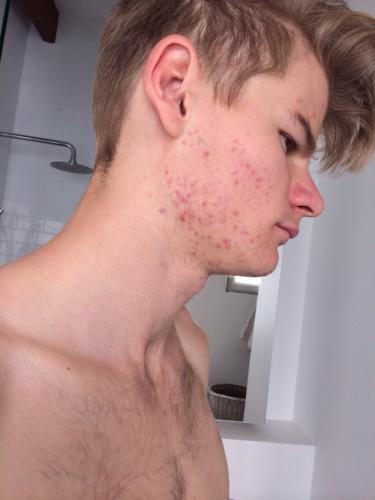 Jack J M