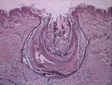axamenta